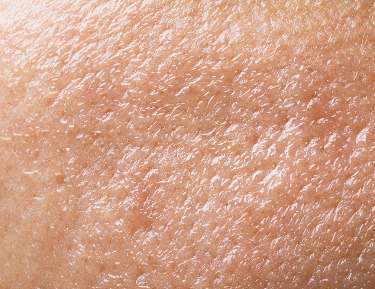 oily skin type