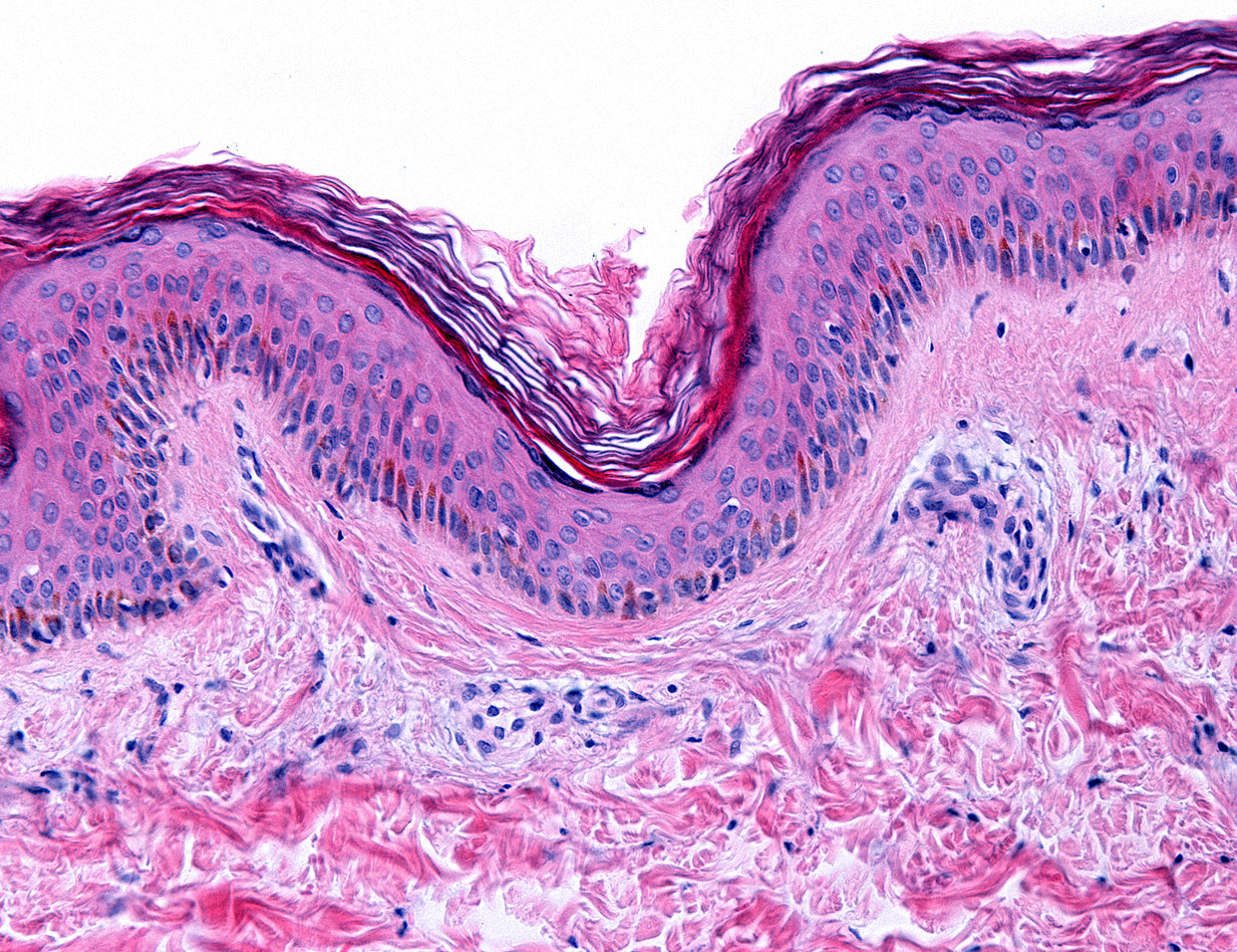 adenosine in skincare