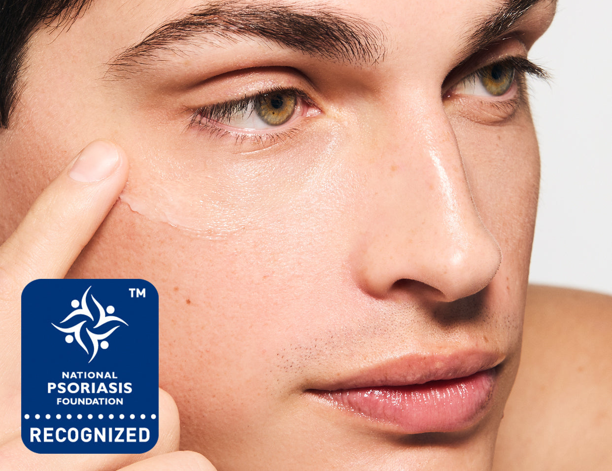 skincare for psoriasis