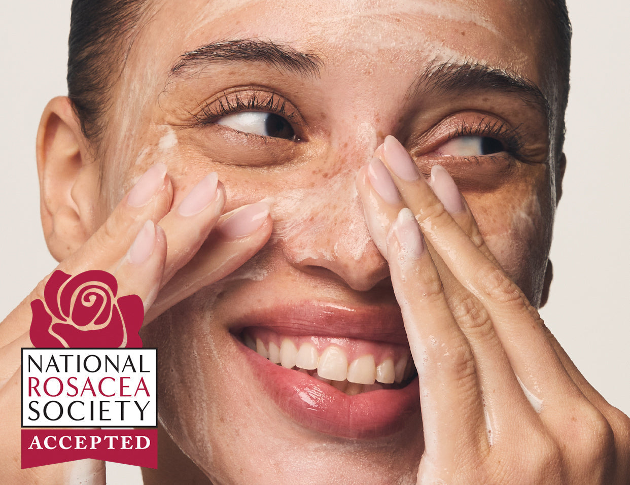 skincare for rosacea