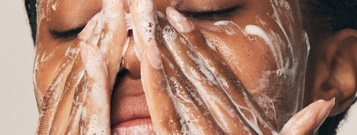 skincare for acne prone skin